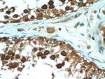 PGAP1 Antibody in Immunohistochemistry (Paraffin) (IHC (P))