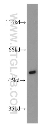 PGAP1 Antibody in Western Blot (WB)