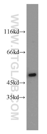 PGAP1 Antibody in Western Blot (WB)