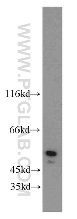 PGAP1 Antibody in Western Blot (WB)