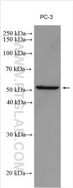 DR3 Antibody in Western Blot (WB)