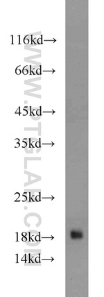 DR3 Antibody in Western Blot (WB)