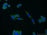 FAM13A Antibody in Immunocytochemistry (ICC/IF)