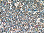 FAM13A Antibody in Immunohistochemistry (Paraffin) (IHC (P))