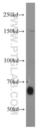 FAM13A Antibody in Western Blot (WB)