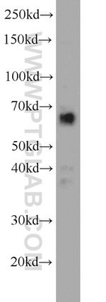 FAM13A Antibody in Western Blot (WB)