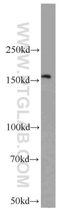 KIF15 Antibody in Western Blot (WB)