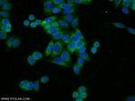 KHSRP Antibody in Immunocytochemistry (ICC/IF)