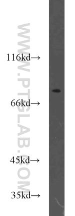 TMEM181 Antibody in Western Blot (WB)