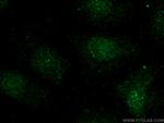 BCL11B Antibody in Immunocytochemistry (ICC/IF)