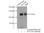 BCL11B Antibody in Immunoprecipitation (IP)