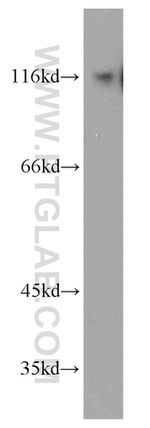 BCL11B Antibody in Western Blot (WB)