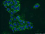 PYGL Antibody in Immunocytochemistry (ICC/IF)