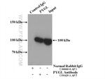 PYGL Antibody in Immunoprecipitation (IP)