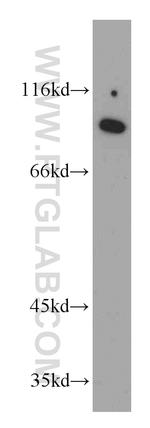 PYGL Antibody in Western Blot (WB)