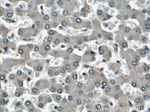 STUB1 Antibody in Immunohistochemistry (Paraffin) (IHC (P))