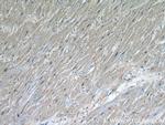 STUB1 Antibody in Immunohistochemistry (Paraffin) (IHC (P))