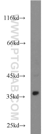 STUB1 Antibody in Western Blot (WB)