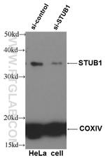 STUB1 Antibody in Western Blot (WB)