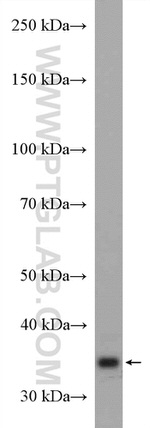 STUB1 Antibody in Western Blot (WB)