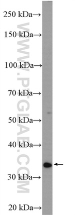 STUB1 Antibody in Western Blot (WB)