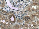 WTX Antibody in Immunohistochemistry (Paraffin) (IHC (P))