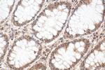 GATA6 Antibody in Immunohistochemistry (Paraffin) (IHC (P))