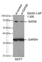 GATA6 Antibody in Western Blot (WB)