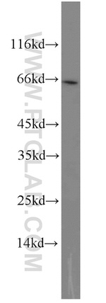 GATA6 Antibody in Western Blot (WB)