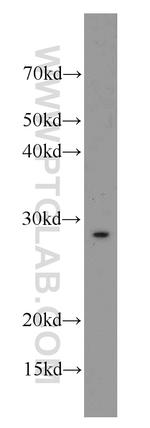 SCN4B Antibody in Western Blot (WB)