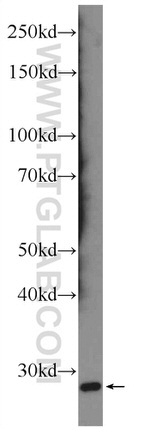 SCN4B Antibody in Western Blot (WB)