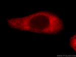 Loricrin Antibody in Immunocytochemistry (ICC/IF)