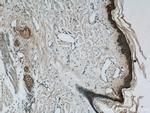 Loricrin Antibody in Immunohistochemistry (Paraffin) (IHC (P))