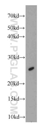 Loricrin Antibody in Western Blot (WB)