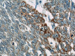 Loricrin Antibody in Immunohistochemistry (Paraffin) (IHC (P))