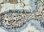 ESR2 Beta-3 Antibody in Immunohistochemistry (Paraffin) (IHC (P))