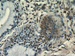 ESR2 Beta-3 Antibody in Immunohistochemistry (Paraffin) (IHC (P))