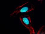 ESR2 Beta-3 Antibody in Immunocytochemistry (ICC/IF)