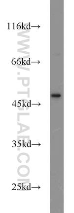 CXCR1 Antibody in Western Blot (WB)