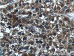 CYP2C19 Antibody in Immunohistochemistry (Paraffin) (IHC (P))