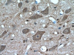 TRIM63 Antibody in Immunohistochemistry (Paraffin) (IHC (P))