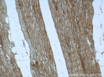 TRIM63 Antibody in Immunohistochemistry (Paraffin) (IHC (P))