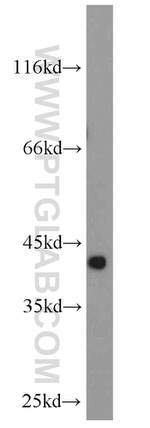 TRIM63 Antibody in Western Blot (WB)