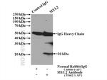 Myosin Light Chain 2 Antibody in Immunoprecipitation (IP)