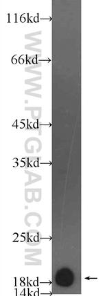 Myosin Light Chain 2 Antibody in Western Blot (WB)