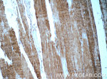 Myosin Light Chain 2 Antibody in Immunohistochemistry (Paraffin) (IHC (P))