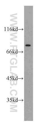 NUP88 Antibody in Western Blot (WB)