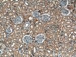 RAB7A Antibody in Immunohistochemistry (Paraffin) (IHC (P))