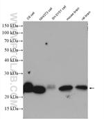 RAB7A Antibody in Western Blot (WB)