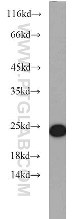 RAB7A Antibody in Western Blot (WB)